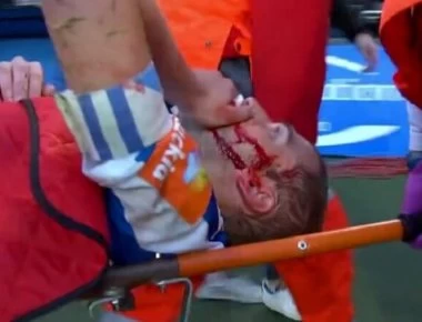 Δολοφονικό τάκλιν σε ισπανικό αγώνα ποδοσφαίρου - Πήγε με τις τάπες στο κεφάλι - Αποχώρησε αιμόφυρτος (βίντεο)